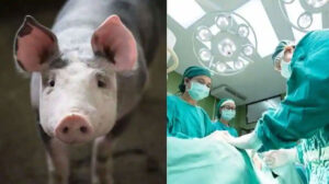 Animal transplants